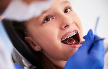 Orthodontic treatment