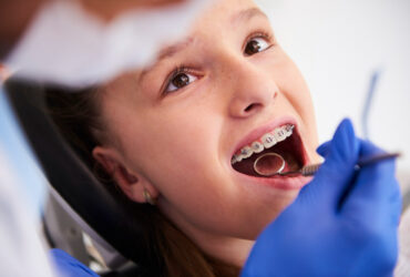 Orthodontic treatment