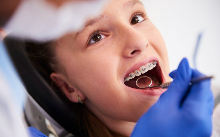 girl-with-braces-during-routine-dental-examination
